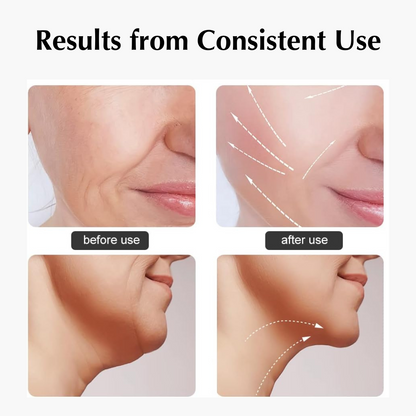 The Velvie Face Sculpting Device (5-in-1)